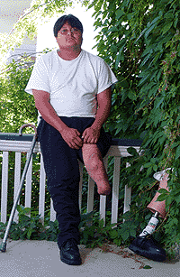 Moises Carranza-Reyes charges that inhumane treatment in a squalid jail cost him a leg. Photo by Mark Manger for Westword.
